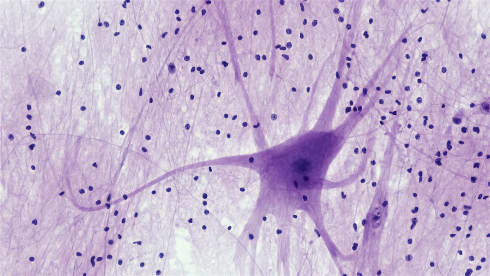 Nervous Tissue: Spinal Cord Motor Neuron